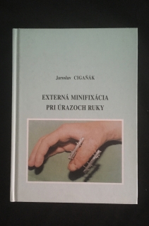 Jaroslav Cigaňák -Externá minifixácia pri úrazoch ruky